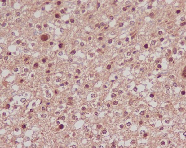Anti-FoxO1a Rabbit Monoclonal Antibody Boster Bio