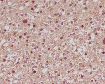 Anti-FoxO1a Rabbit Monoclonal Antibody Boster Bio