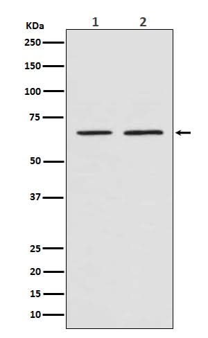 Anti-Smad4 Rabbit Monoclonal Antibody Boster Bio