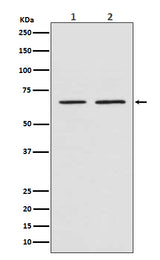 Anti-Smad4 Rabbit Monoclonal Antibody Boster Bio