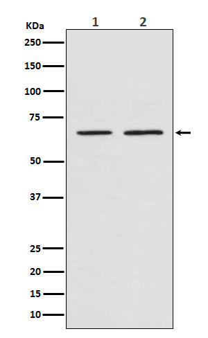 Anti-Smad4 Rabbit Monoclonal Antibody Boster Bio