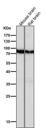 Anti-B Raf Rabbit Monoclonal Antibody Boster Bio