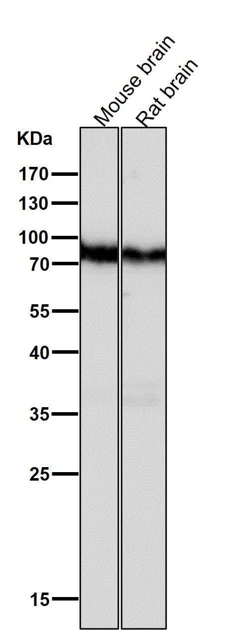Anti-B Raf Rabbit Monoclonal Antibody Boster Bio