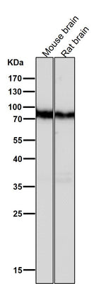 Anti-B Raf Rabbit Monoclonal Antibody Boster Bio