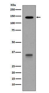 Anti-LDL Receptor Rabbit Monoclonal Antibody Boster Bio