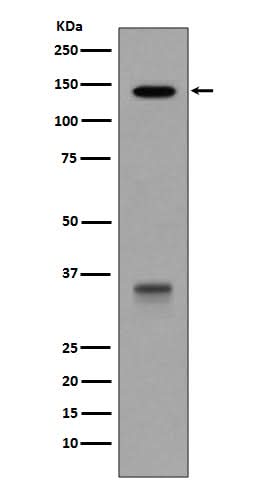 Anti-LDL Receptor Rabbit Monoclonal Antibody Boster Bio