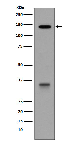 Anti-LDL Receptor Rabbit Monoclonal Antibody Boster Bio