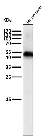 Anti-Caspase-9 CASP9 Rabbit Monoclonal Antibody Boster Bio