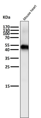 Anti-Caspase-9 CASP9 Rabbit Monoclonal Antibody Boster Bio