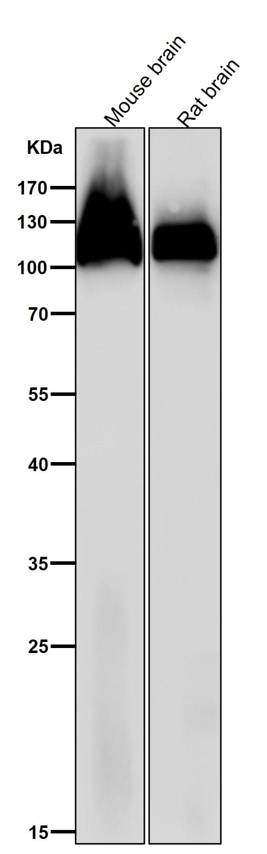 Anti-Amyloid beta A4 APP Rabbit Monoclonal Antibody Boster Bio