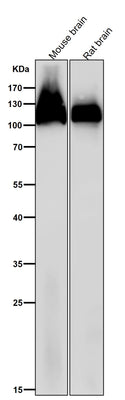 Anti-Amyloid beta A4 APP Rabbit Monoclonal Antibody Boster Bio
