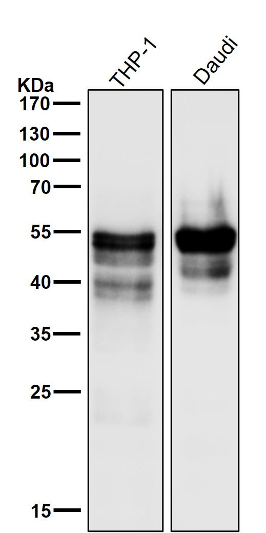Anti-RUNX1/RUNX2/RUNX3 Rabbit Monoclonal Antibody Boster Bio