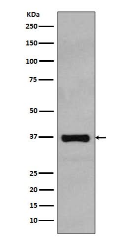 Anti-Rad51 Rabbit Monoclonal Antibody Boster Bio