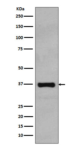 Anti-Rad51 Rabbit Monoclonal Antibody Boster Bio