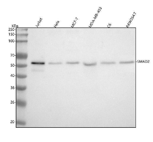 Anti-Smad2 Rabbit Monoclonal Antibody Boster Bio