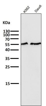 Anti-Smad2 Rabbit Monoclonal Antibody Boster Bio