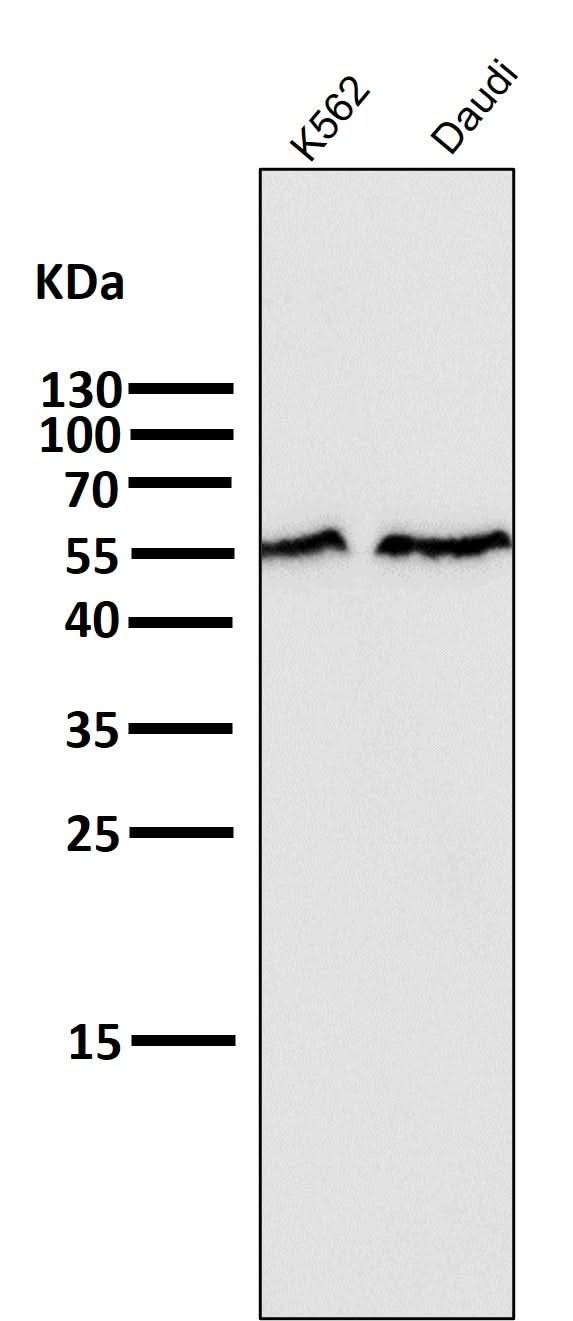 Anti-Smad2 Rabbit Monoclonal Antibody Boster Bio