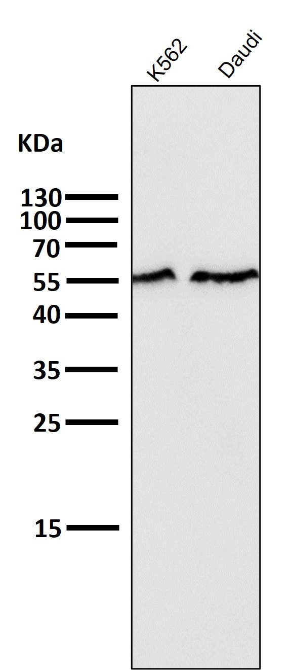 Anti-Smad2 Rabbit Monoclonal Antibody Boster Bio