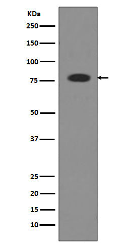 Anti-Transferrin TF Rabbit Monoclonal Antibody Boster Bio