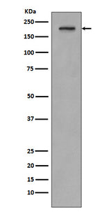 Anti-PDGF Receptor beta PDGFRB Rabbit Monoclonal Antibody Boster Bio