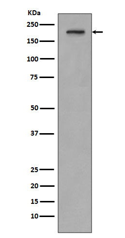 Anti-PDGF Receptor beta PDGFRB Rabbit Monoclonal Antibody Boster Bio