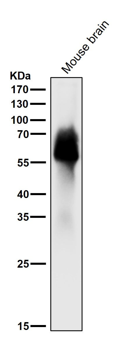 Anti-Tau MAPT Rabbit Monoclonal Antibody Boster Bio