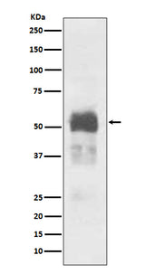 Anti-Tau MAPT Rabbit Monoclonal Antibody Boster Bio