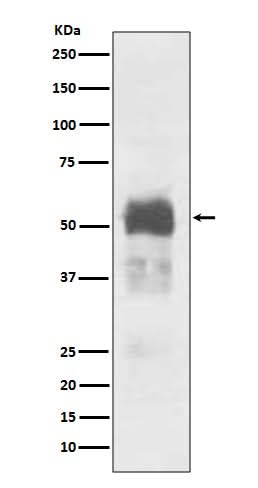 Anti-Tau MAPT Rabbit Monoclonal Antibody Boster Bio