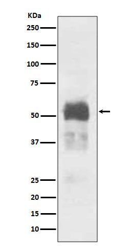 Anti-Tau MAPT Rabbit Monoclonal Antibody Boster Bio