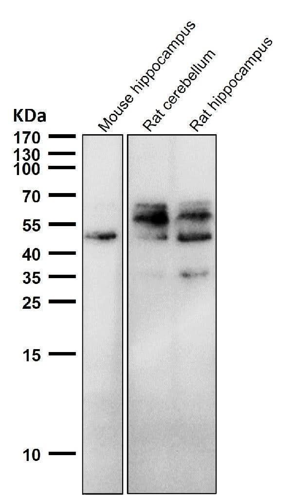 Anti-Phospho-Tau (S198) Rabbit Monoclonal Antibody Boster Bio