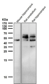 Anti-Phospho-Tau (S198) Rabbit Monoclonal Antibody Boster Bio