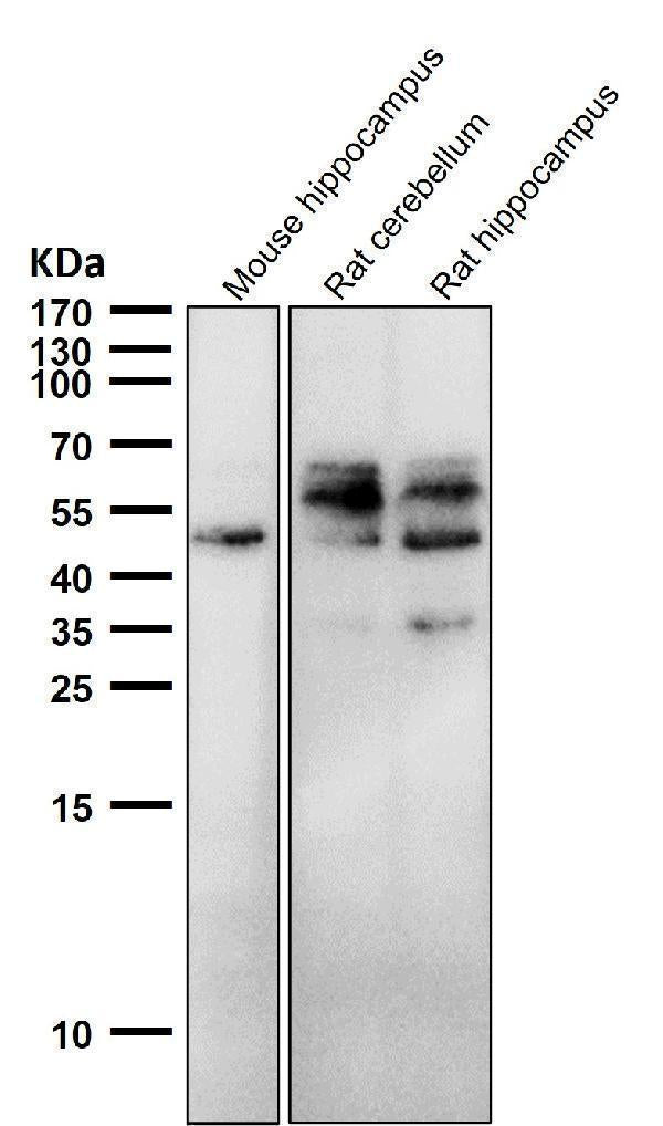 Anti-Phospho-Tau (S198) Rabbit Monoclonal Antibody Boster Bio