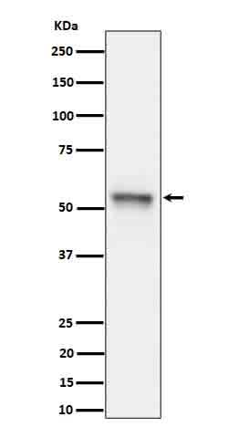 Anti-Phospho-Tau (S199) Rabbit Monoclonal Antibody Boster Bio