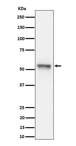 Anti-Phospho-Tau (S199) Rabbit Monoclonal Antibody Boster Bio