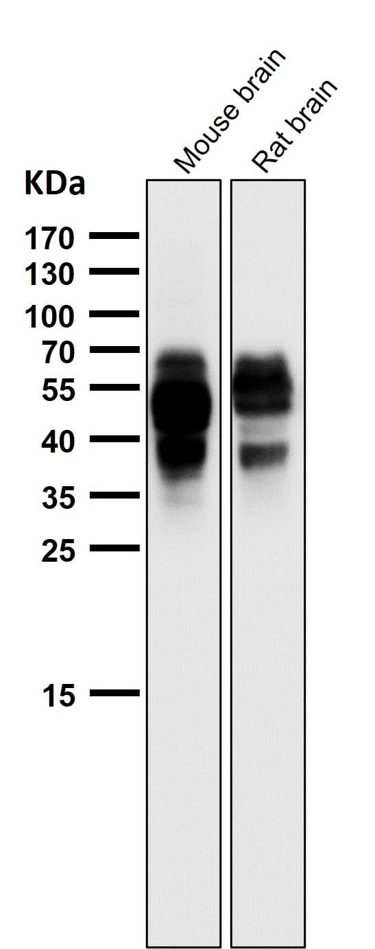 Anti-Phospho-Tau (S202) Rabbit Monoclonal Antibody Boster Bio