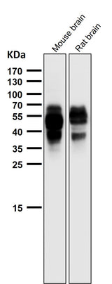 Anti-Phospho-Tau (S202) Rabbit Monoclonal Antibody Boster Bio