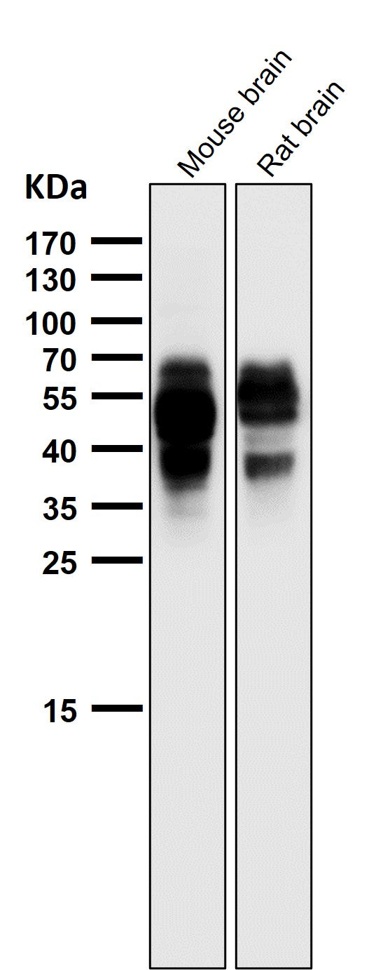 Anti-Phospho-Tau (S202) Rabbit Monoclonal Antibody Boster Bio