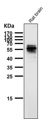 Anti-Phospho-Tau (S214) Rabbit Monoclonal Antibody Boster Bio