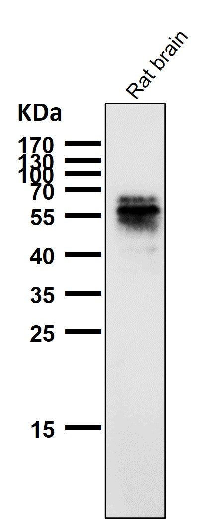 Anti-Phospho-Tau (S214) Rabbit Monoclonal Antibody Boster Bio