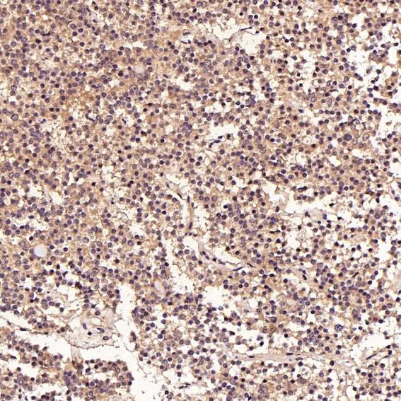 Anti-FGFR1 Rabbit Monoclonal Antibody Boster Bio