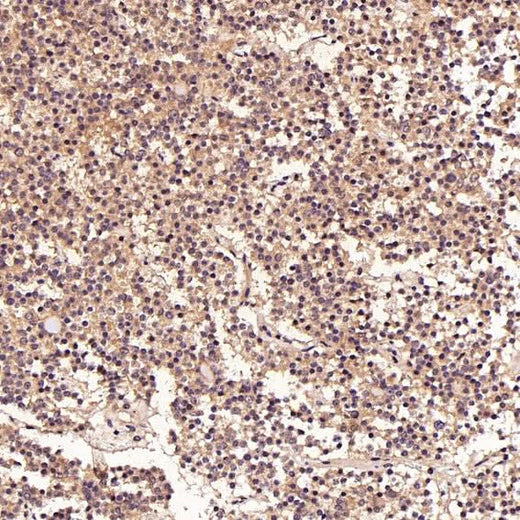 Anti-FGFR1 Rabbit Monoclonal Antibody Boster Bio