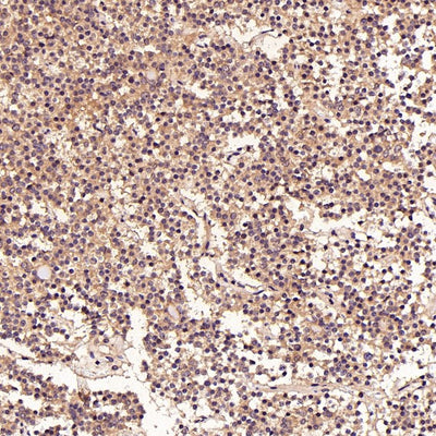 Anti-FGFR1 Rabbit Monoclonal Antibody Boster Bio
