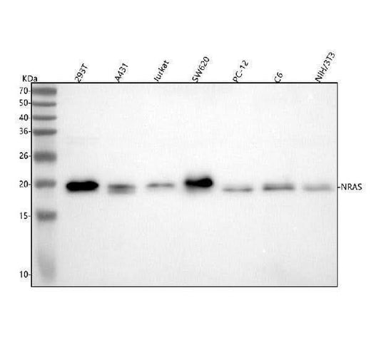 Anti-KRAS+HRAS+NRAS Rabbit Monoclonal Antibody Boster Bio
