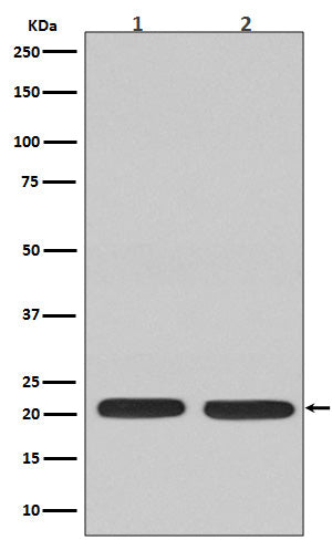 Anti-Ras NRAS Rabbit Monoclonal Antibody Boster Bio