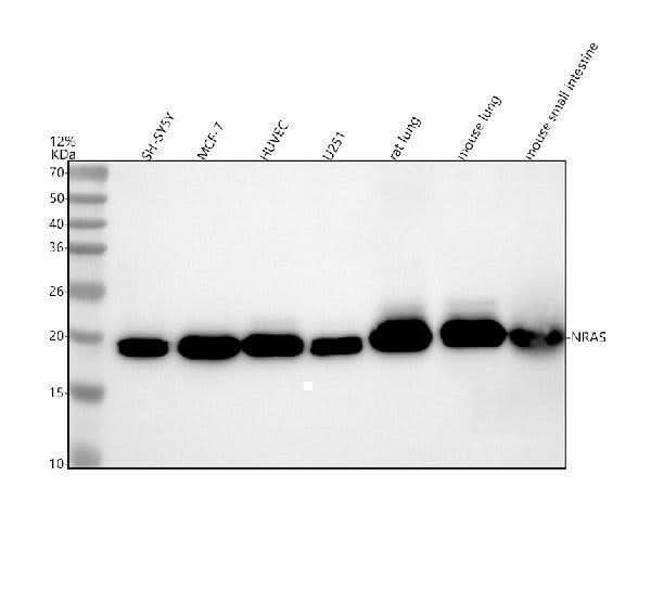 Anti-Ras NRAS Rabbit Monoclonal Antibody Boster Bio