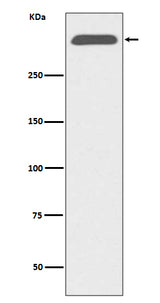 Anti-ApoB/Apolipoprotein B Rabbit Monoclonal Antibody Boster Bio