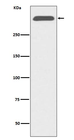 Anti-ApoB/Apolipoprotein B Rabbit Monoclonal Antibody Boster Bio