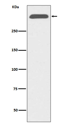 Anti-ApoB/Apolipoprotein B Rabbit Monoclonal Antibody Boster Bio