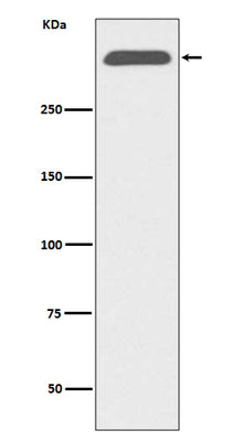 Anti-ApoB/Apolipoprotein B Rabbit Monoclonal Antibody Boster Bio