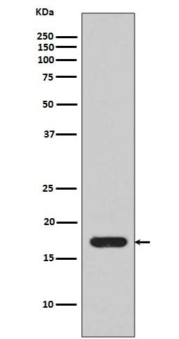 Anti-IL1 beta Rabbit Monoclonal Antibody Boster Bio